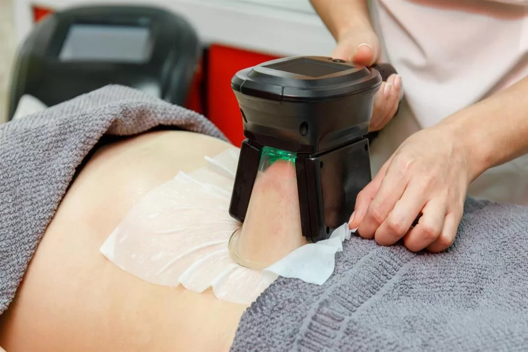 آلية التبريد لتقليل السيلوليت