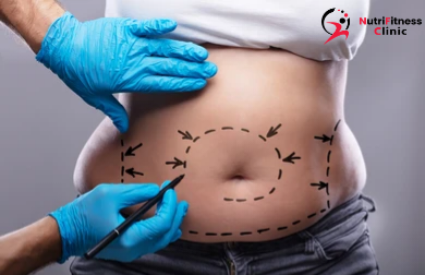 جلسات نحت وتنسيق القوام بدون جراحة هل تؤدي إلى نتيجة فعلا ؟