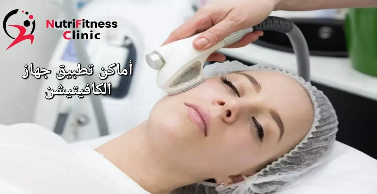 اماكن يمكن فيها استخدام جهاز الكافيتيشن