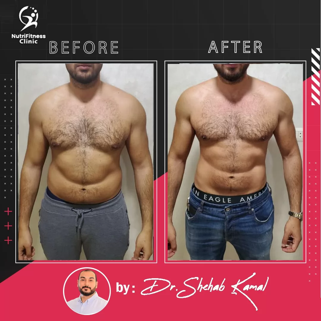 أفضل نظام غذائي لعلاج السمنة