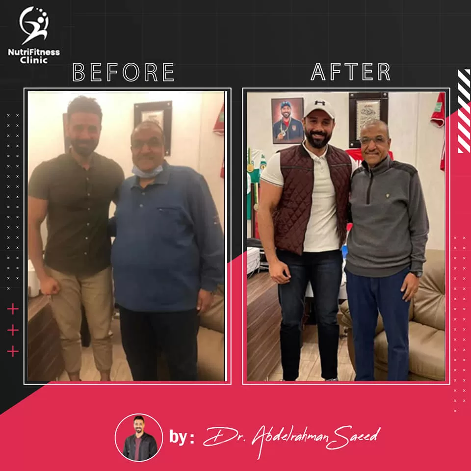 أفضل نظام غذائي لعلاج السمنة