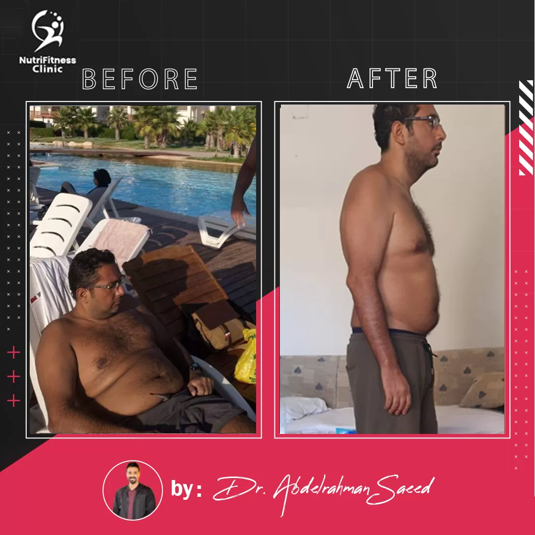 أفضل نظام غذائي لعلاج السمنة