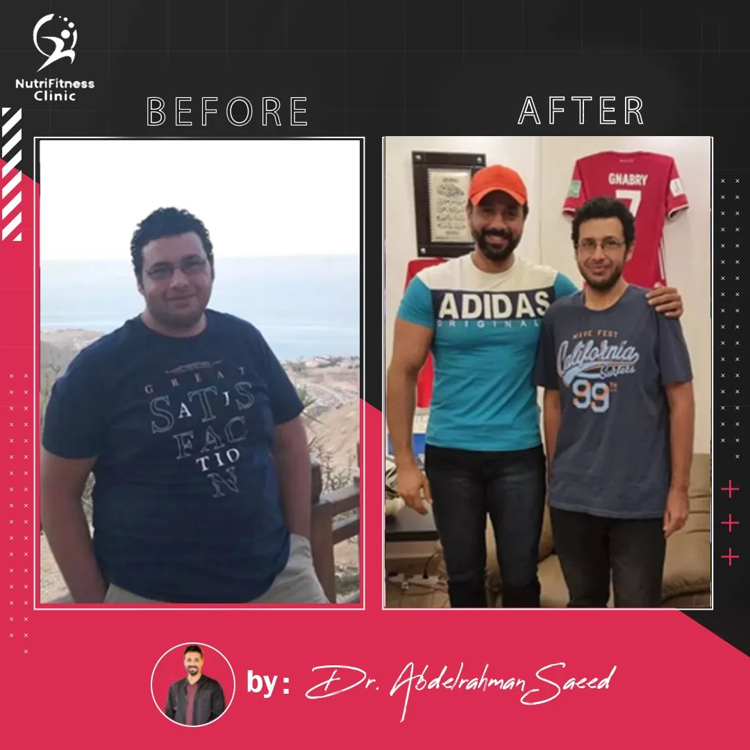 أفضل نظام غذائي لعلاج السمنة