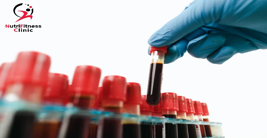 ما هي التحاليل المطلوبة لمعرفة سبب زيادة الوزن؟