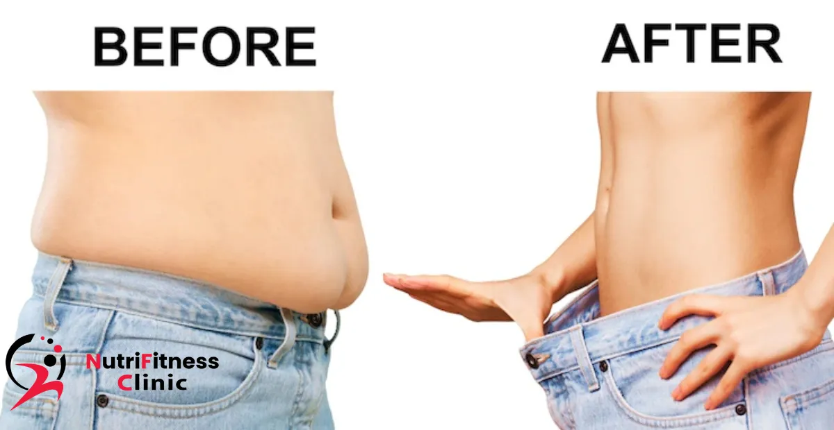 تأثير نزول الوزن على الجسم وخاصًة منطقة البطن 