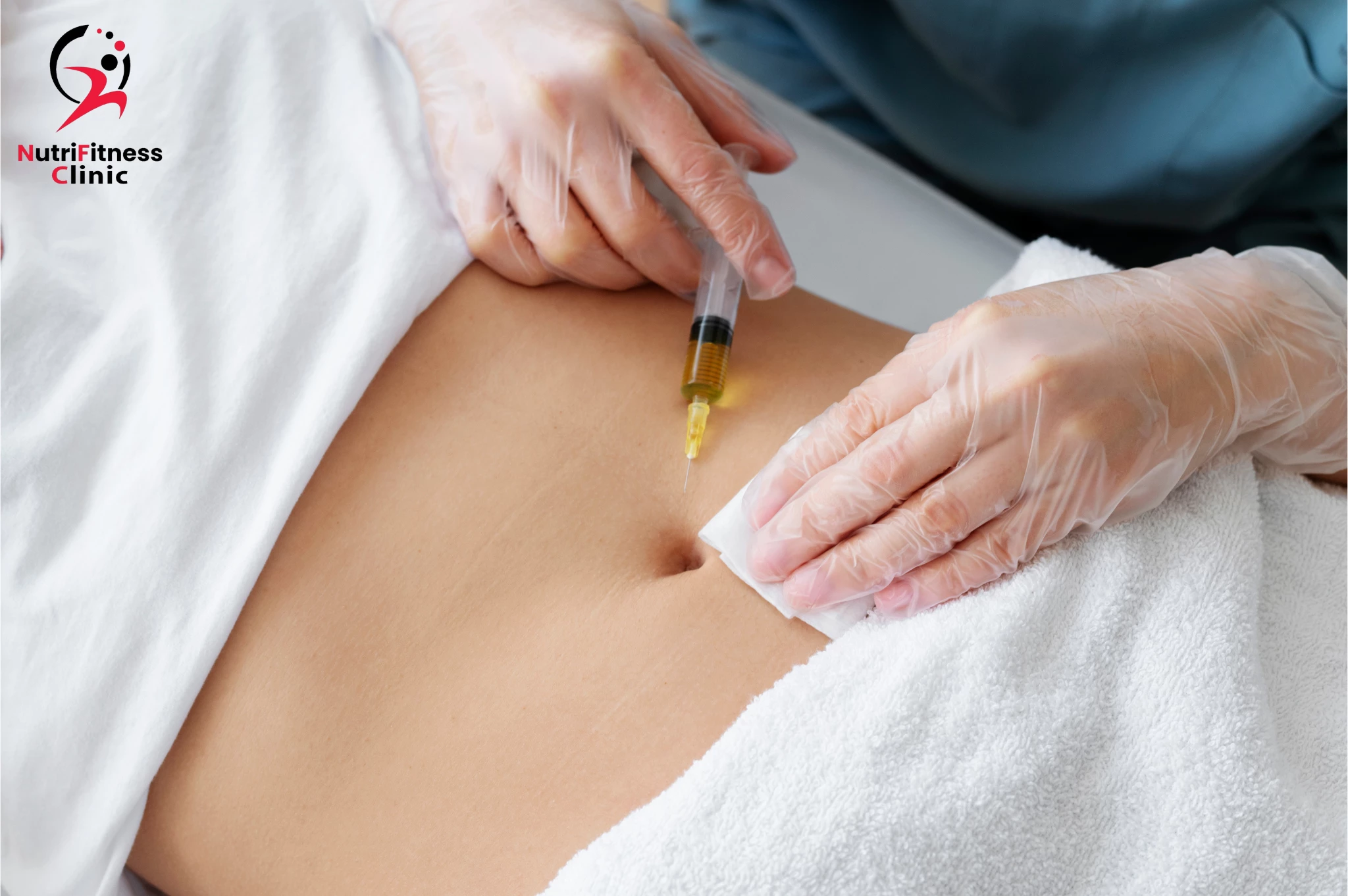 حقن الميزوثيرابي