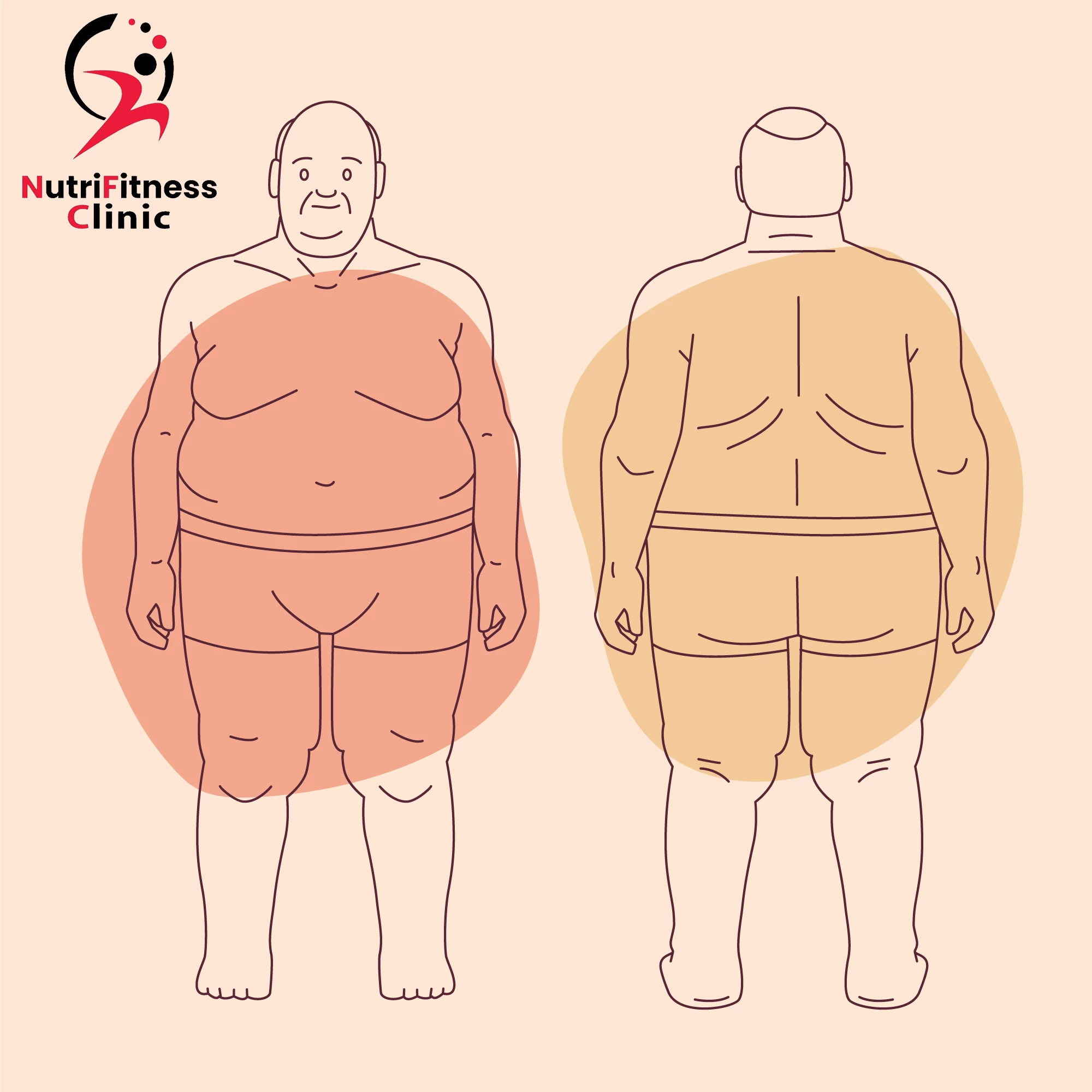 الفرق بين نحت الجسم وشفط الدهون